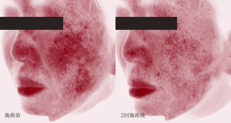 症例写真