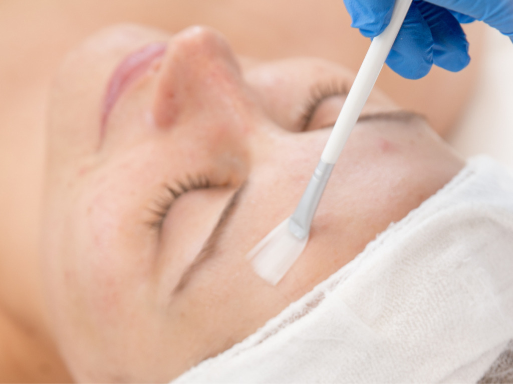 全顔グリコール酸ピーリング＋毛穴ケア＋イオン導入