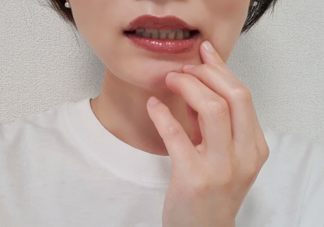 唇のピリピリ・水ぶくれは「口唇ヘルペス」かも?