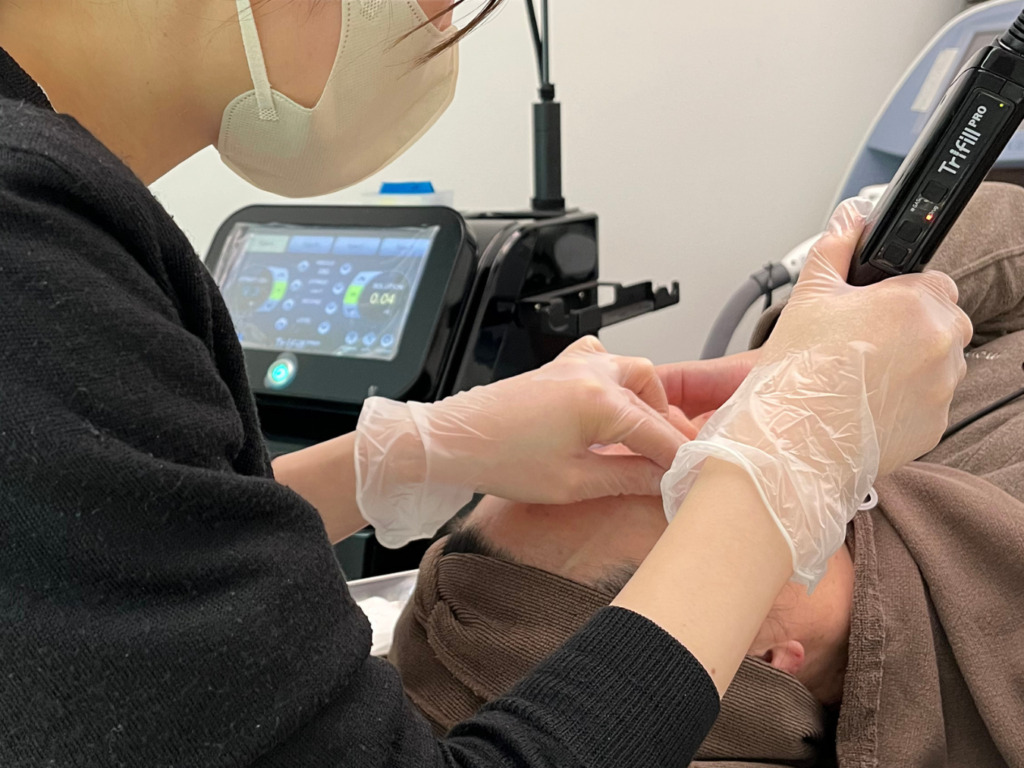 ①全顔トライフィルプロ　¥77,000