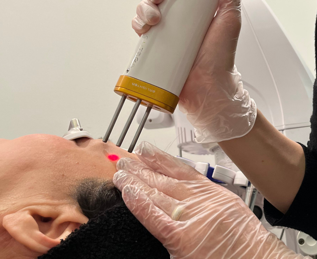 ピコおまかせプログラムピコトーニング＋フラクショナル＋ピコスポット＋毛穴ケア＋イオン導入